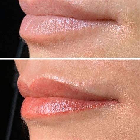 lip blushing skin.